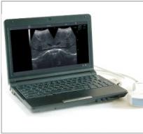 Notebook B ultrasound